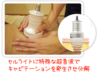 �ʐ^�P